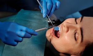 Hvordan man får en tandkrone: Behandling i Søborg